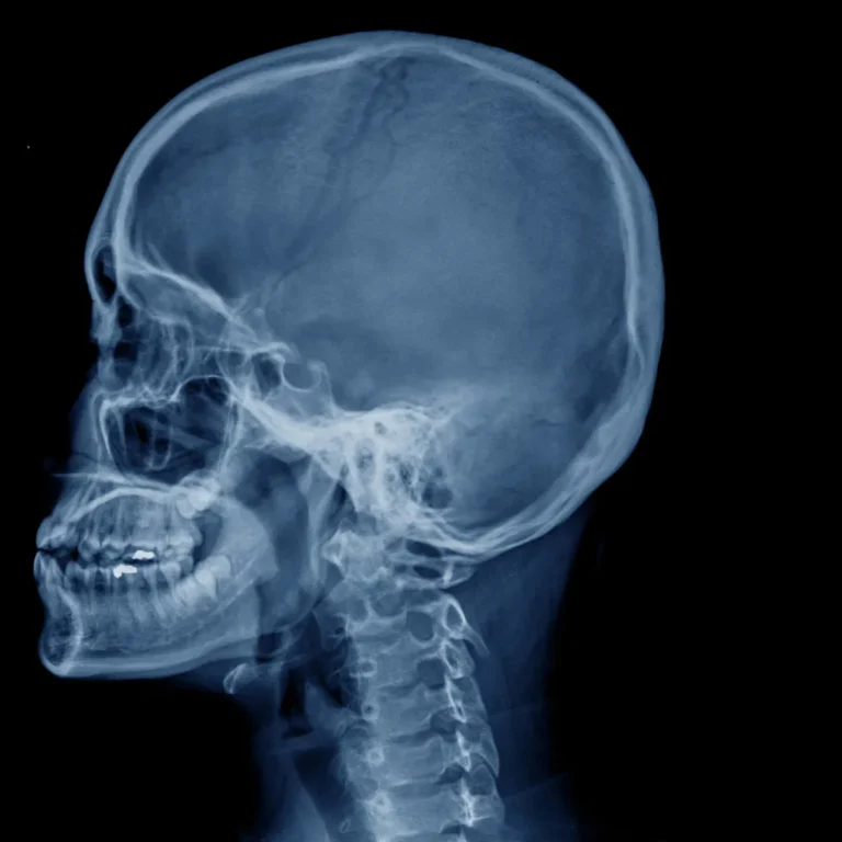 Cérebro da transação tributária