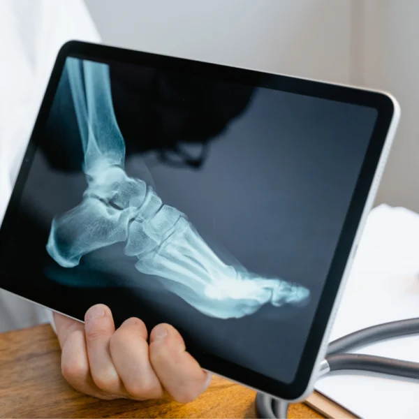 Calcanhar de Aquiles da Transação Tributária